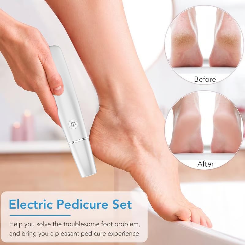 Last Day 49% OFF!Electric Feet Callus Remover