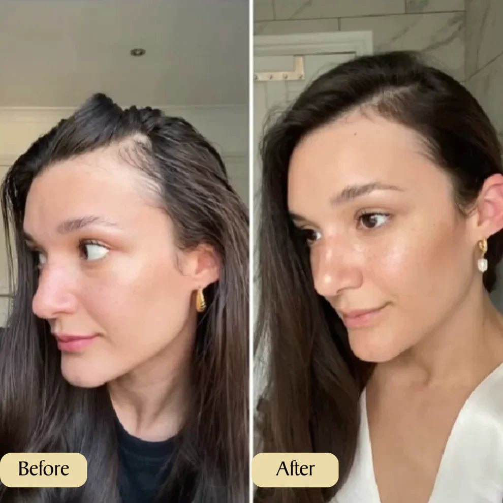 Spring Sale 49% OFF! Natural Hair Growth Oil