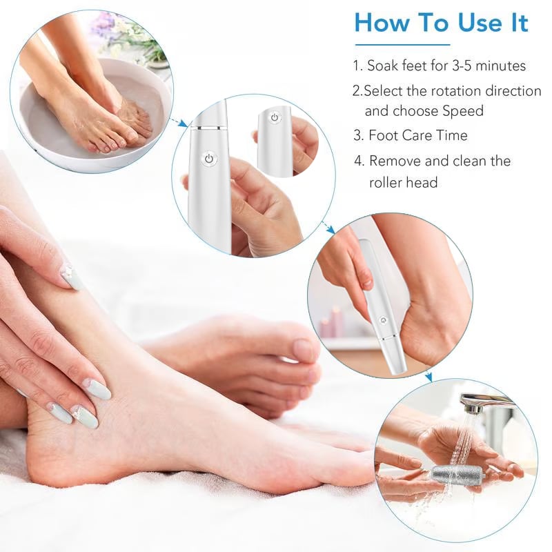 Last Day 49% OFF!Electric Feet Callus Remover