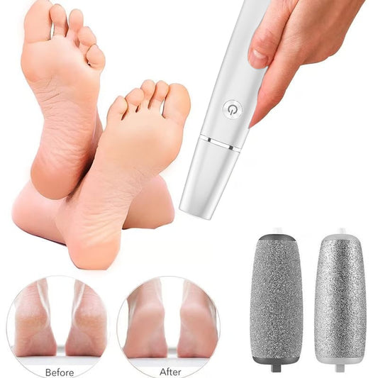 Last Day 49% OFF!Electric Feet Callus Remover