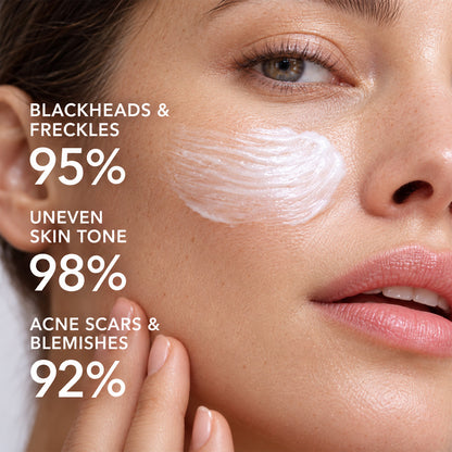Lazzda Highly effective whitening and spot-lightening cream