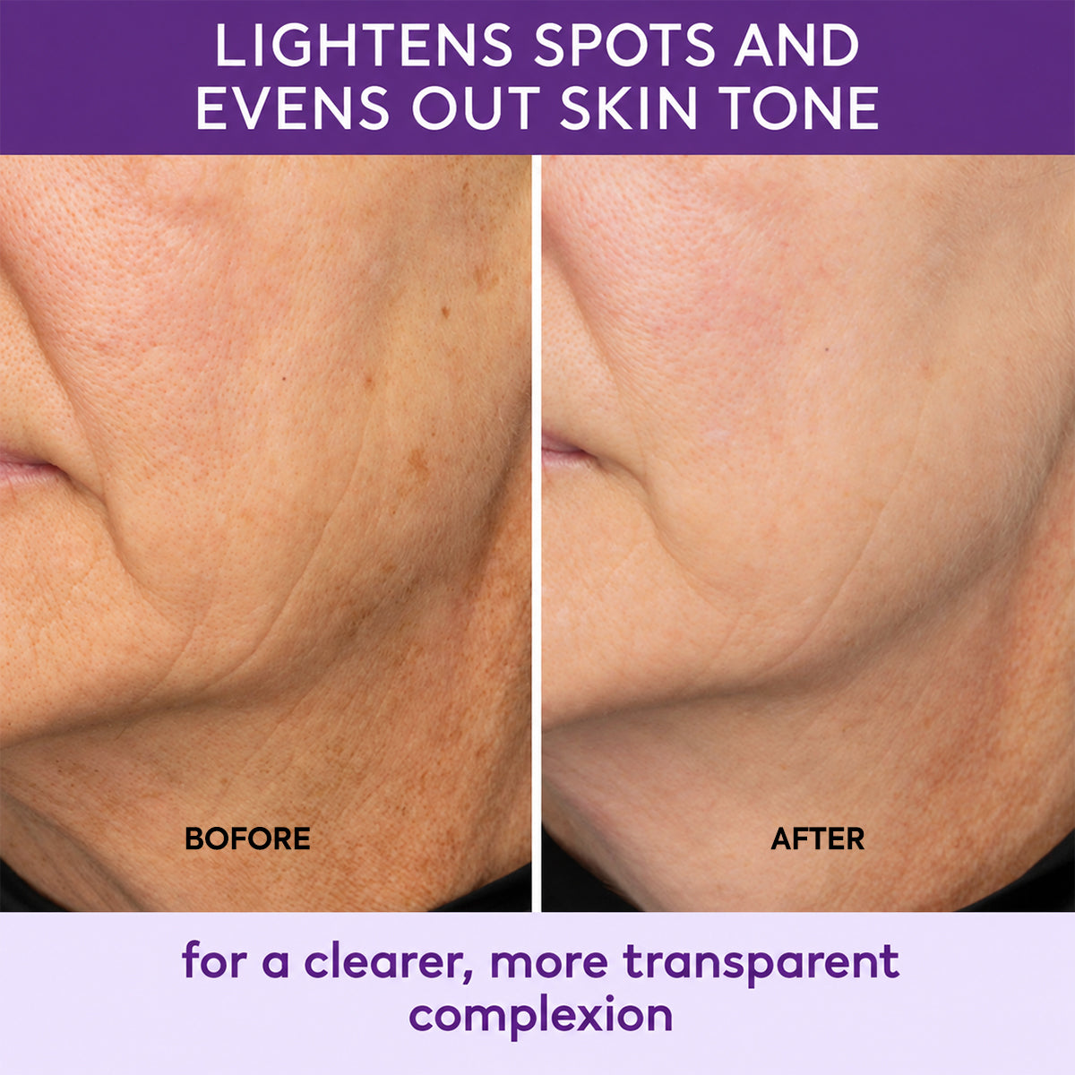Highly effective whitening and spot-lightening cream