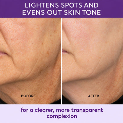 Lazzda Highly effective whitening and spot-lightening cream