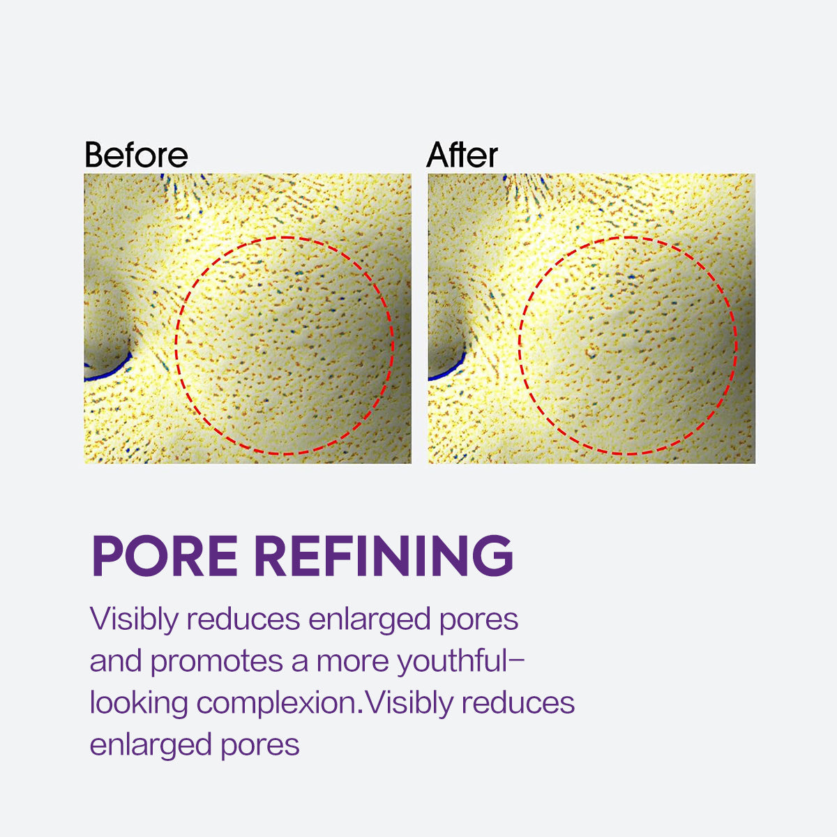 Highly effective whitening and spot-lightening cream