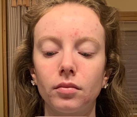 Placeholder image for a sample moisturizer review