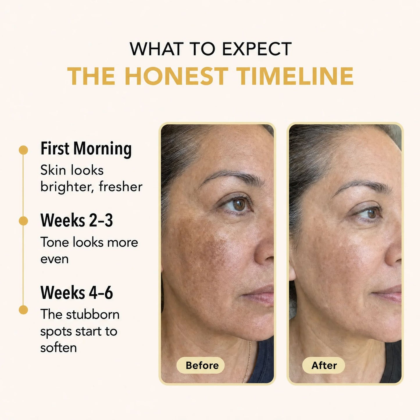 Lazzda Turmeric & Kojic Acid Overnight Mask