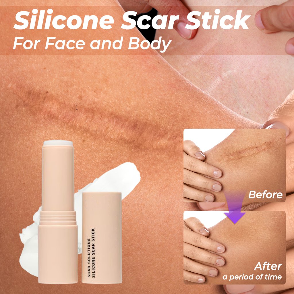 SCAR SOLUTIONS - Silicone Scar Stick - For Face and Body