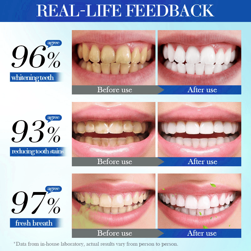 Hydroxyapatite Toothpaste 7.5% for Enamel Teeth Whitening Refreshing Flavor Fluorid