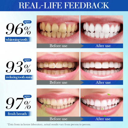 Hydroxyapatite Toothpaste 7.5% for Enamel Teeth Whitening Refreshing Flavor Fluorid