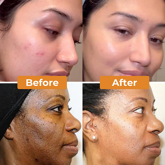 Golden Glow Tumeric Soap