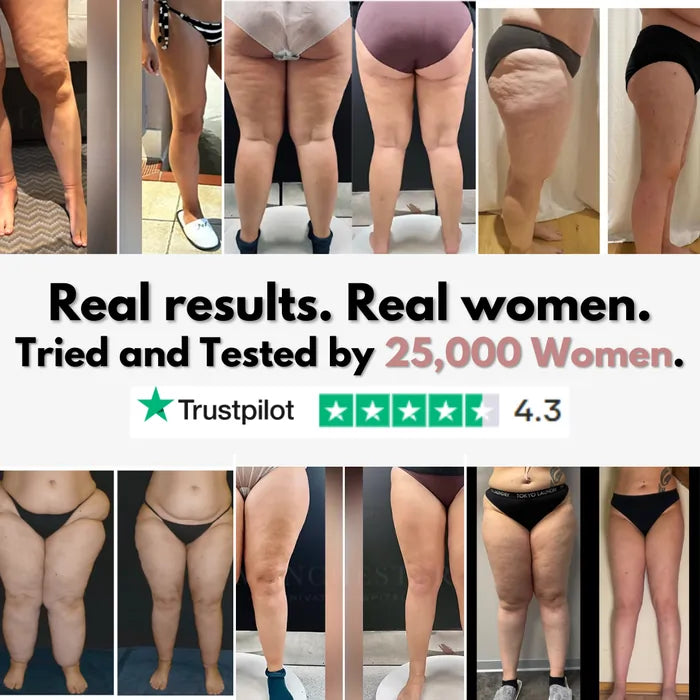 Lazzda 3D Legging – Say goodbye to lipoedema pain and swelling naturally