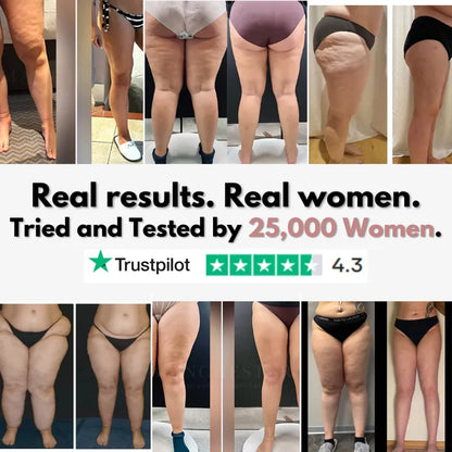 Lazzda 3D Legging – Say goodbye to lipoedema pain and swelling naturally
