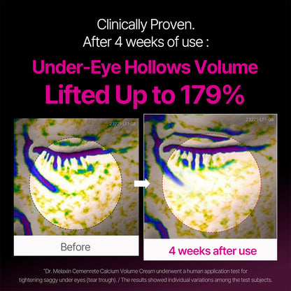 Cemenrete Calcium Dark Spot Eye Cream