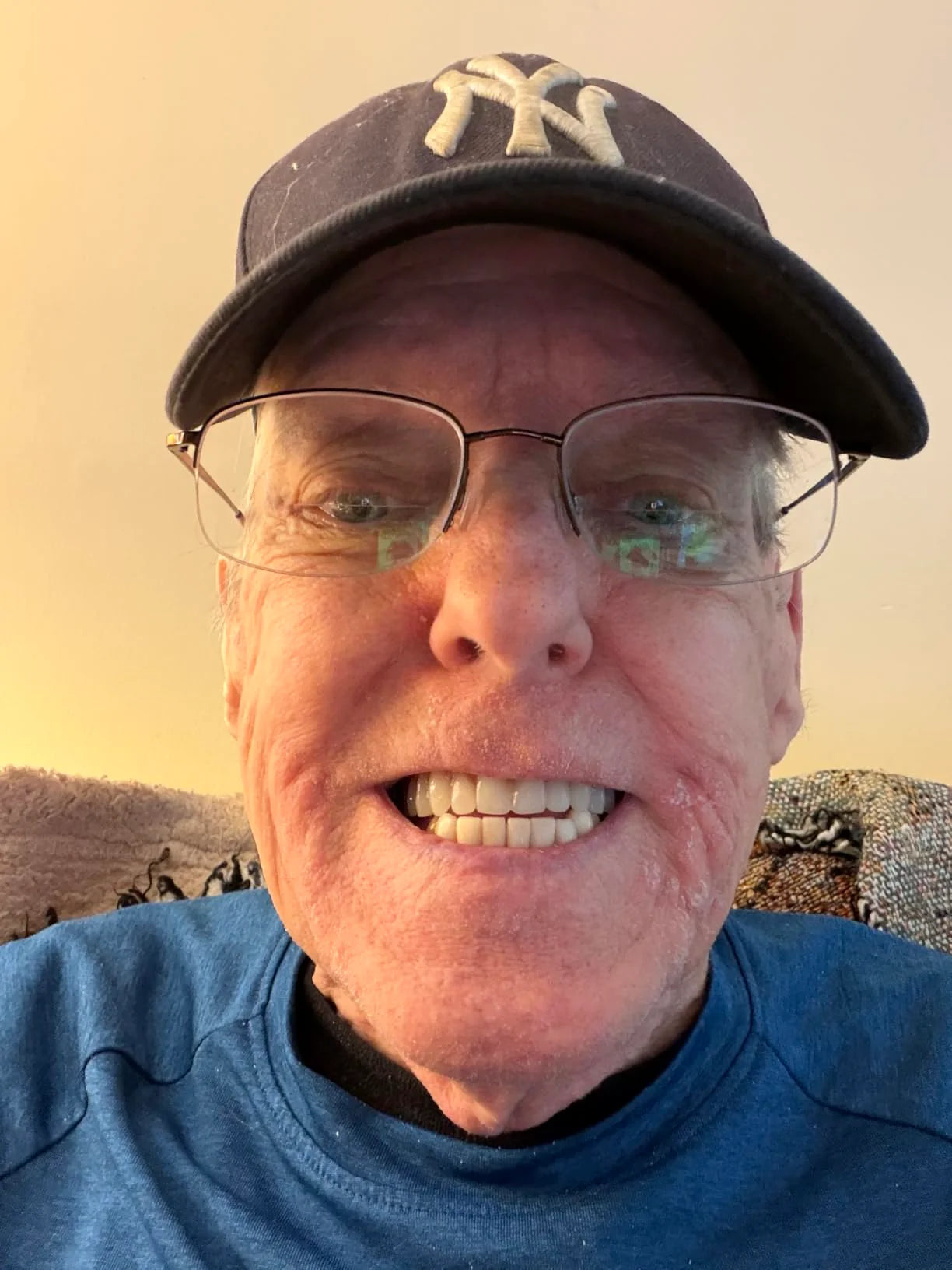 Premium Full Cover Dentures