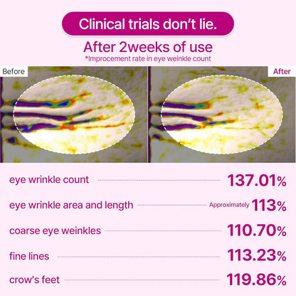 Cemenrete Calcium Dark Spot Eye Cream