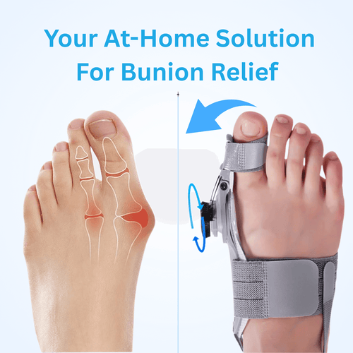 Lazzda Bunion Corrector