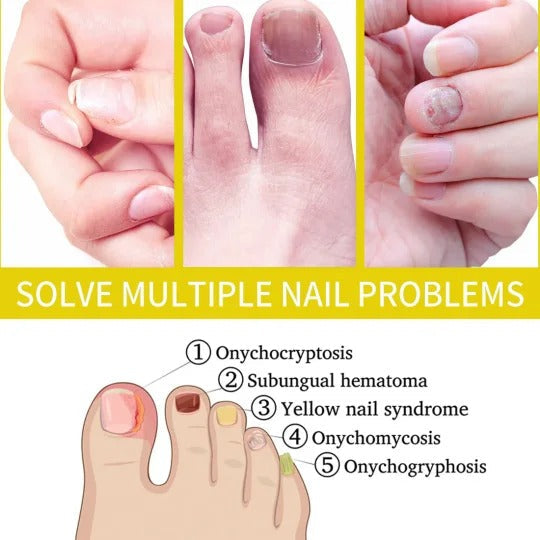 Nail Growth AndStrengthening Serum