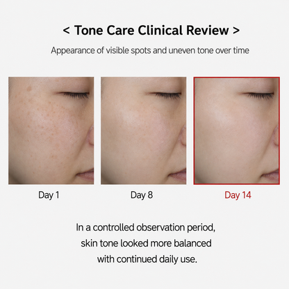 TX Cream -for Dark Spots & Hyperpigmentation