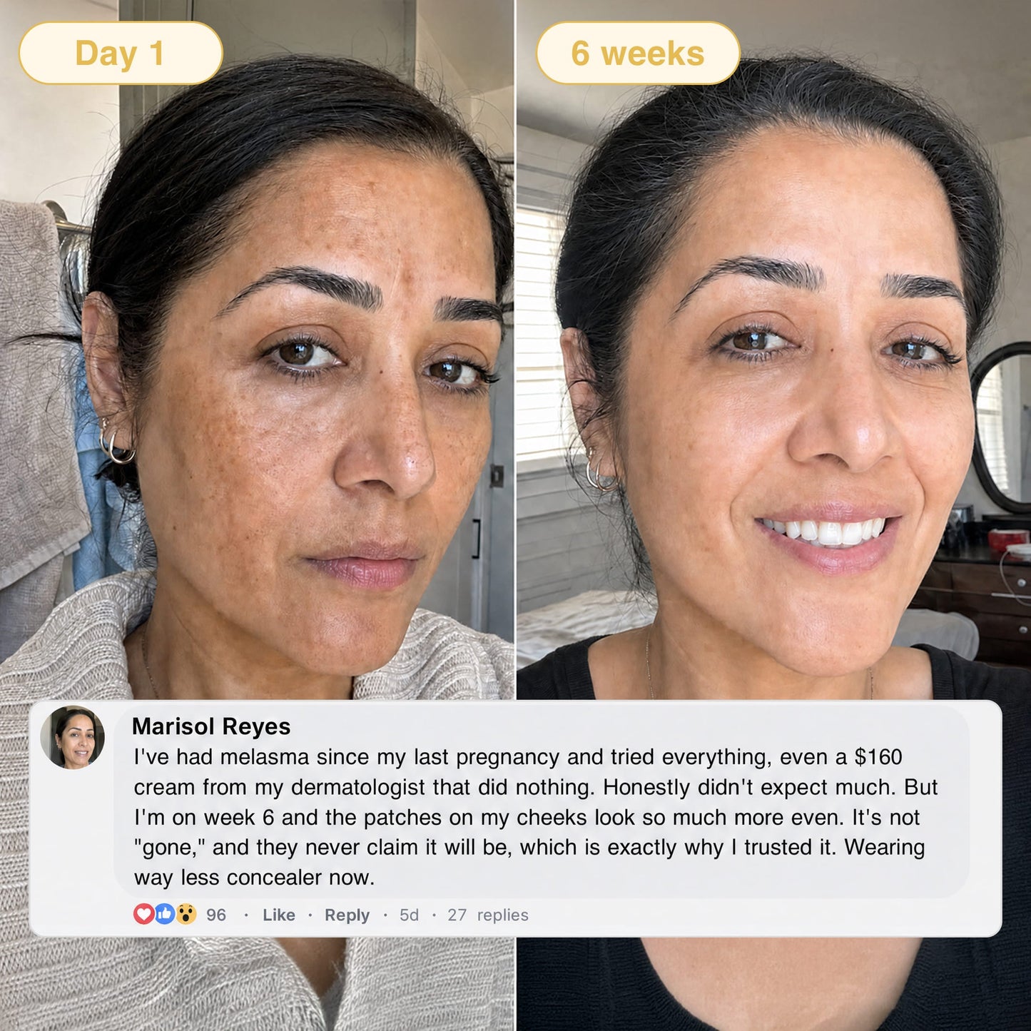Lazzda Turmeric & Kojic Acid Overnight Mask