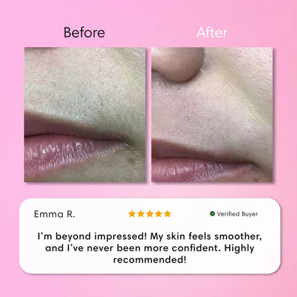 Hair Removal Kit
