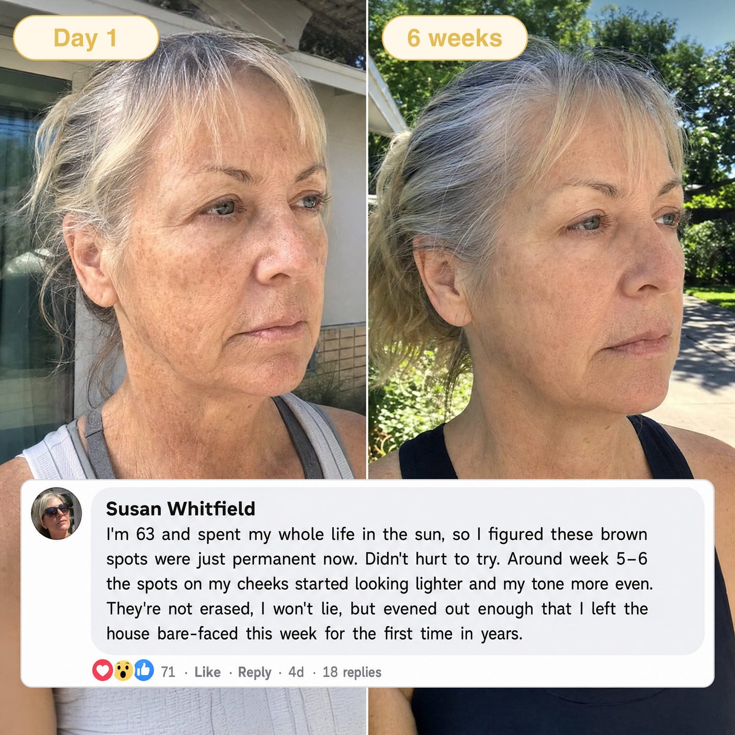 Lazzda Turmeric & Kojic Acid Overnight Mask