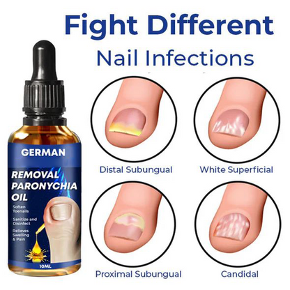 Lazzda Removal Paronychia