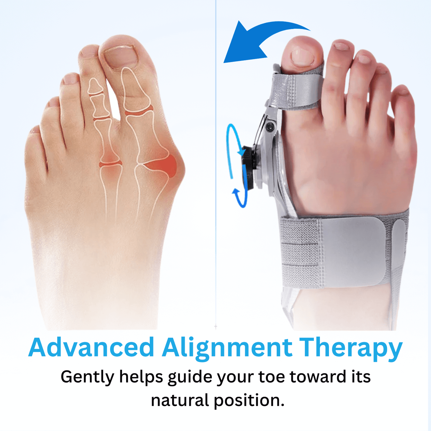 Lazzda Bunion Corrector
