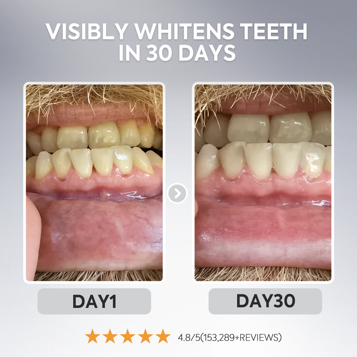 Nano (n-Ha) Toothpaste