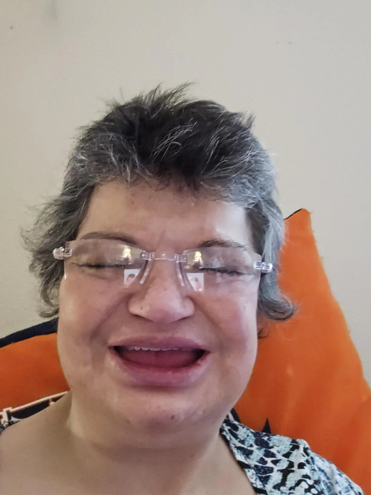 Premium Full Cover Dentures