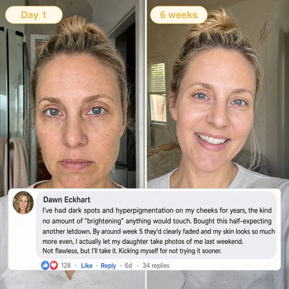 Lazzda Turmeric & Kojic Acid Overnight Mask