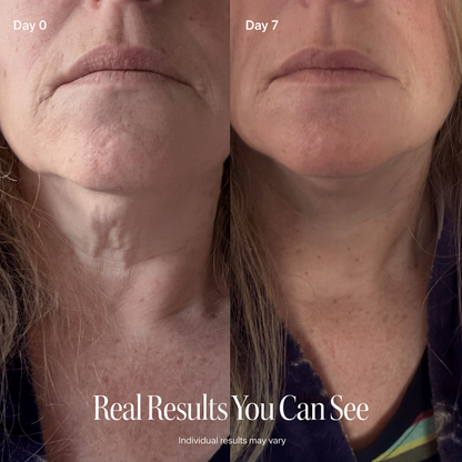 LAZZDA NECK FIRMING CREAM