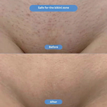 Lazzda Smoothing Serum