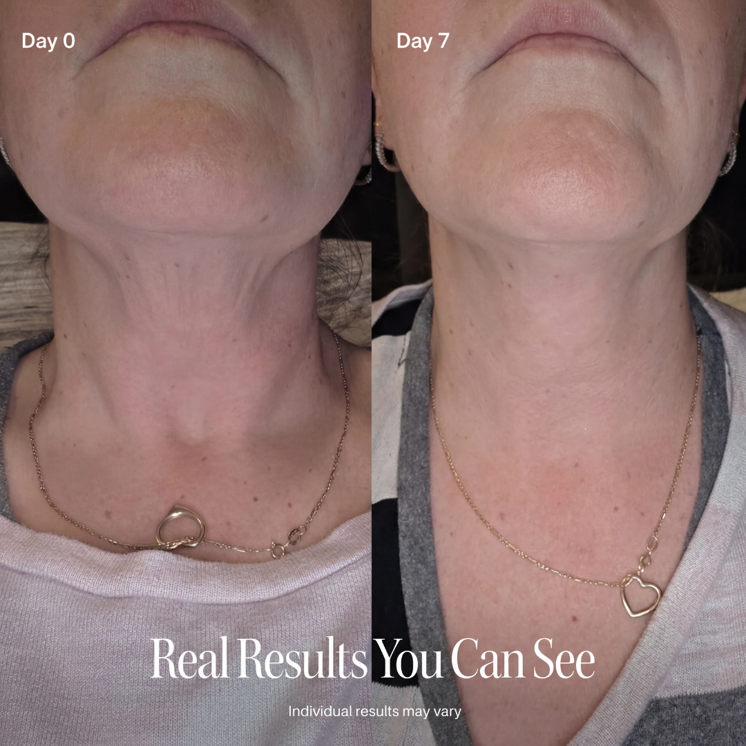 LAZZDA NECK FIRMING CREAM