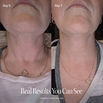LAZZDA NECK FIRMING CREAM