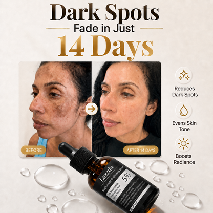 Lazzda 5% Niacinamide + Alpha Arbutin Dark Spot Serum