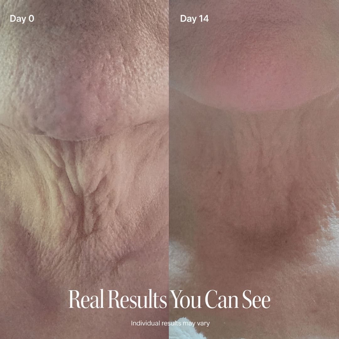 LAZZDA NECK FIRMING CREAM