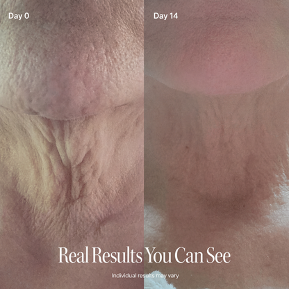 LAZZDA NECK FIRMING CREAM