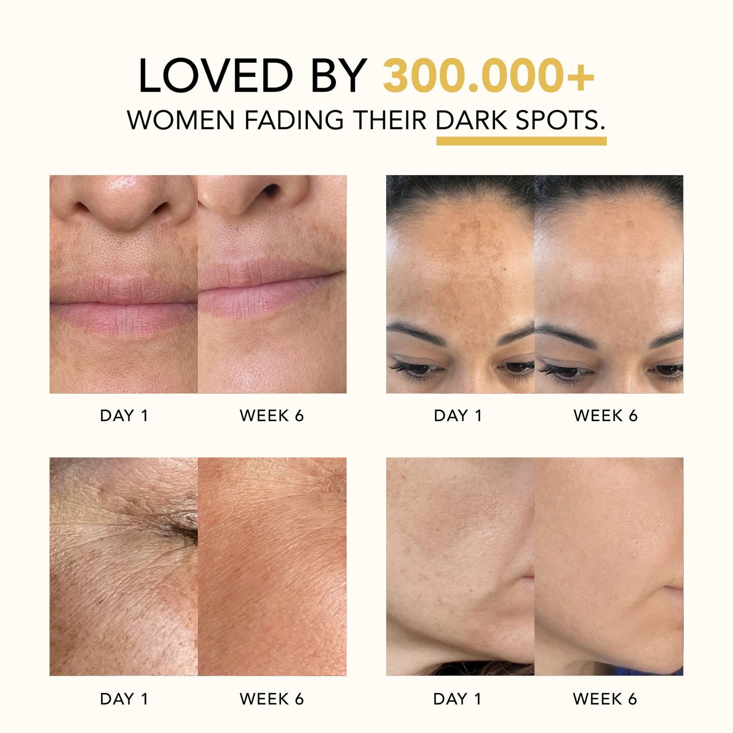 Lazzda Turmeric & Kojic Acid Overnight Mask