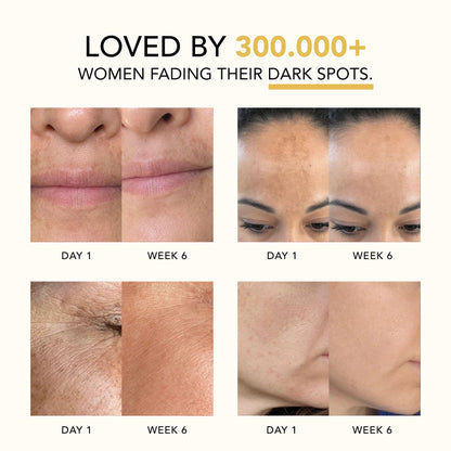 Lazzda Turmeric & Kojic Acid Overnight Mask