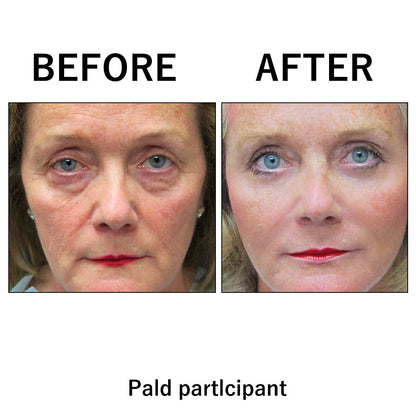 Temporary Face Tightener