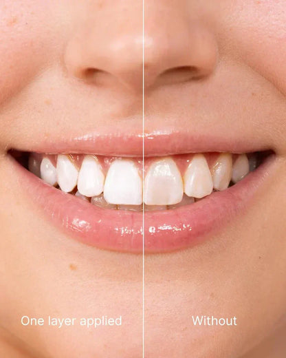 Lazzda Tooth Whitening - Instant Clean Smile