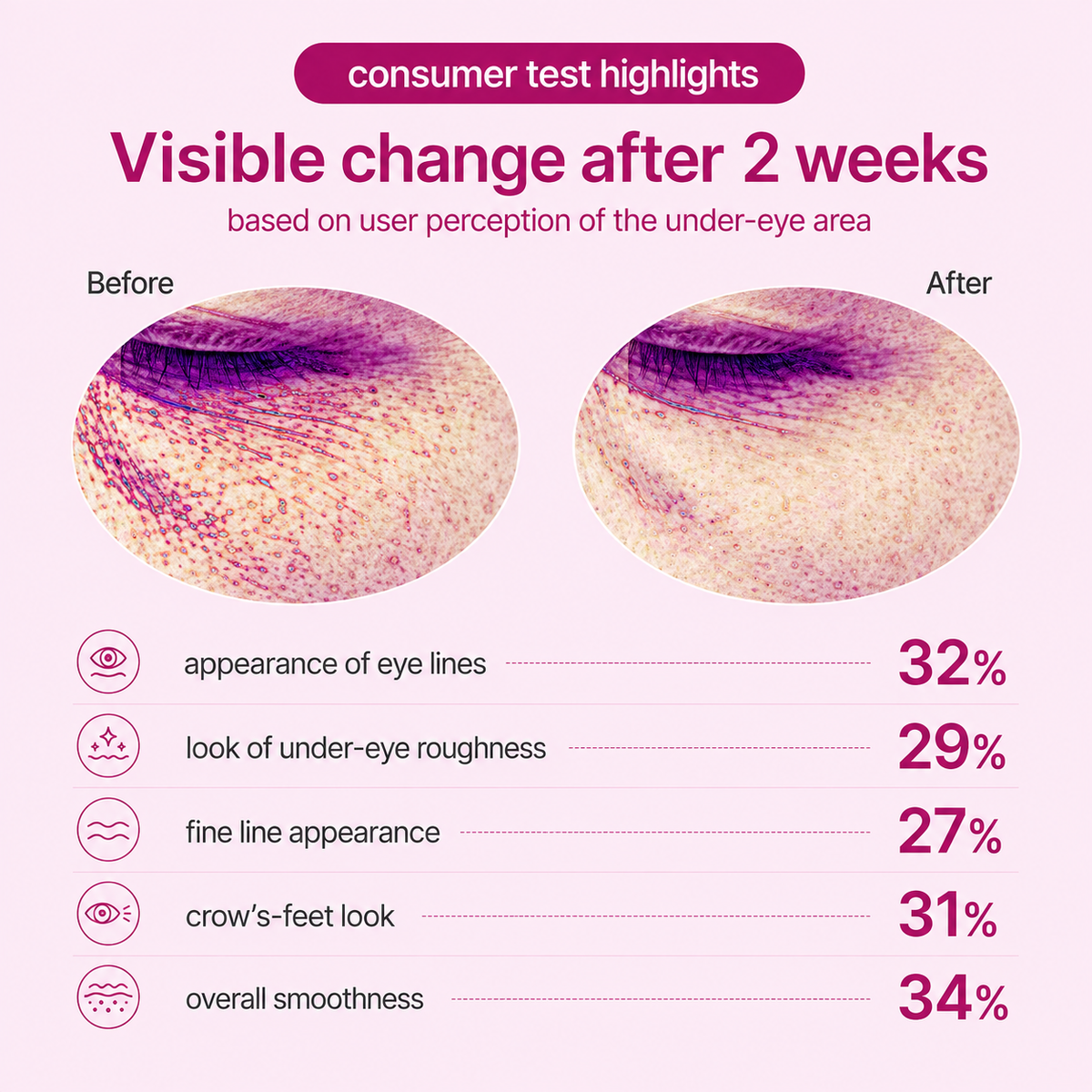Cemenrete Calcium Dark Spot Eye Cream