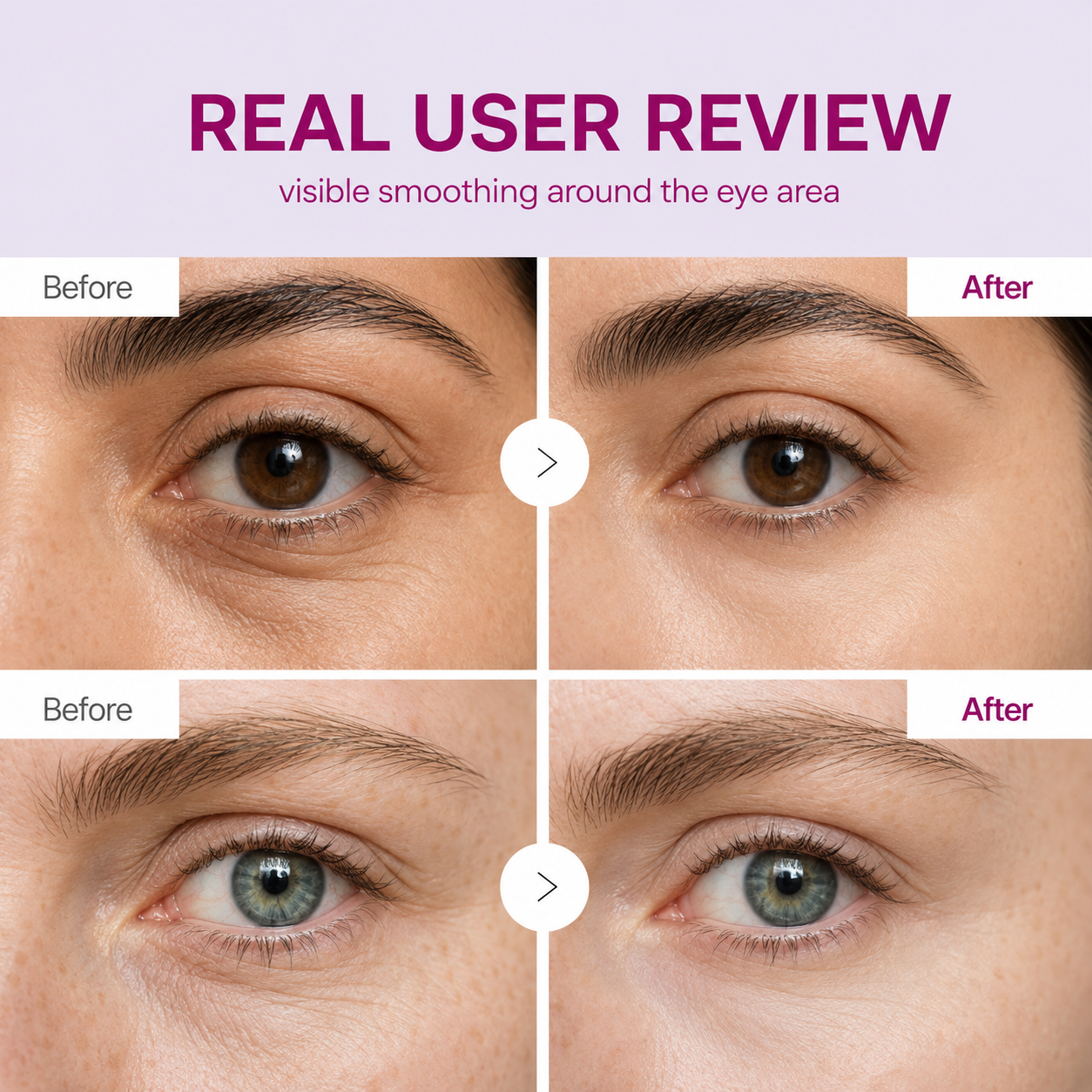 Cemenrete Calcium Dark Spot Eye Cream