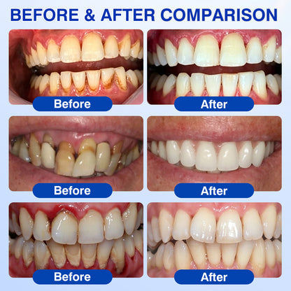 Periodontal Repair Gel