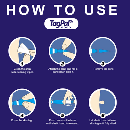 Skin Tag Removal Kit