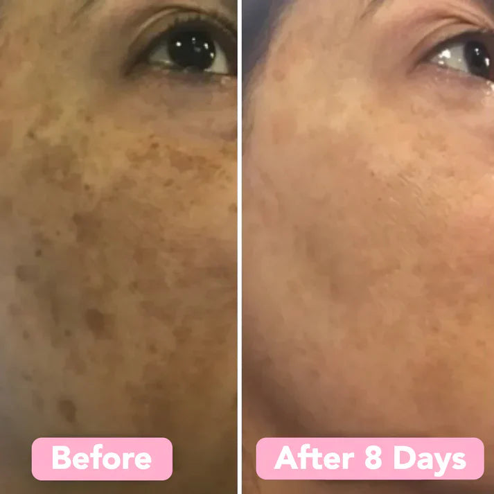 Turmeric Kojic Acid Cleansing Pads