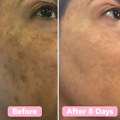 Turmeric Kojic Acid Cleansing Pads