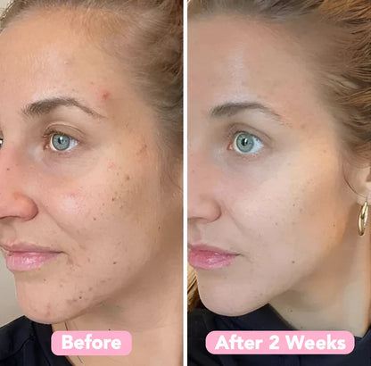 Turmeric Kojic Acid Cleansing Pads