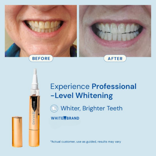 Extra-Strength Teeth Whitener Pen