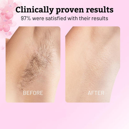SmoothSkin Hair-Reducing Oil